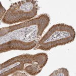 Atlas Antibodies Anti-NPC1 Antibody