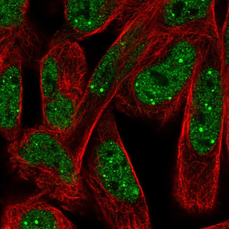 Atlas Antibodies Anti-NPAT Antibody