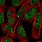 Atlas Antibodies Anti-NPAT Antibody