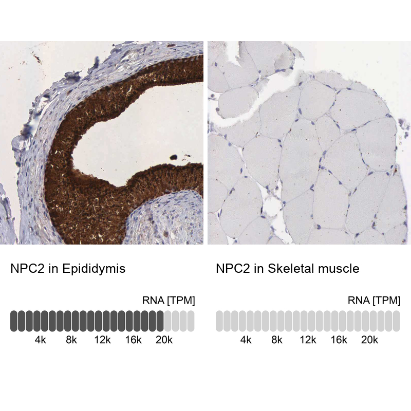 Atlas Antibodies Anti-NPC2 Antibody