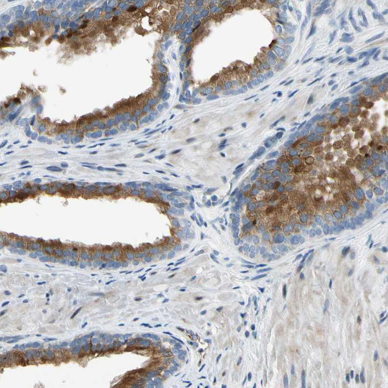 Atlas Antibodies Anti-NPDC1 Antibody