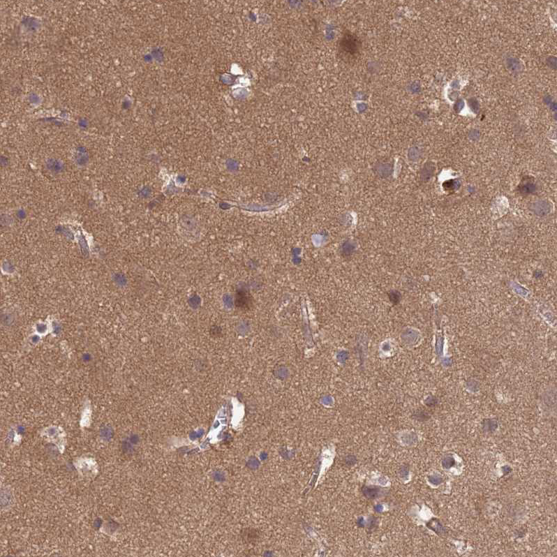 Atlas Antibodies Anti-NPEPPS Antibody
