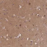 Atlas Antibodies Anti-NPEPPS Antibody