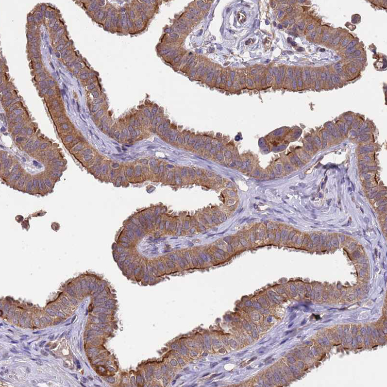 Atlas Antibodies Anti-NPHP1 Antibody