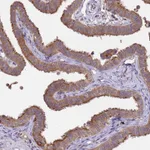 Atlas Antibodies Anti-NPHP1 Antibody