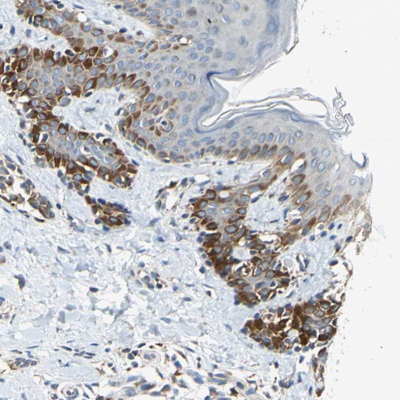 Atlas Antibodies Anti-NPHP3 Antibody