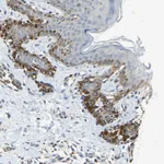 Atlas Antibodies Anti-NPHP3 Antibody