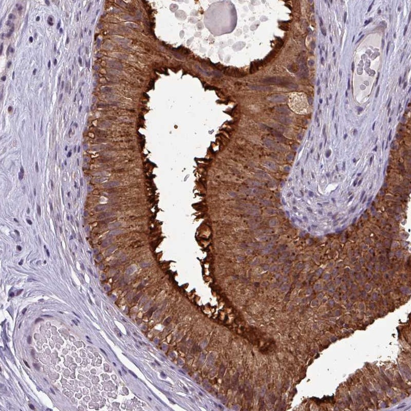 Atlas Antibodies Anti-NPFFR1 Antibody