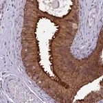 Atlas Antibodies Anti-NPFFR1 Antibody