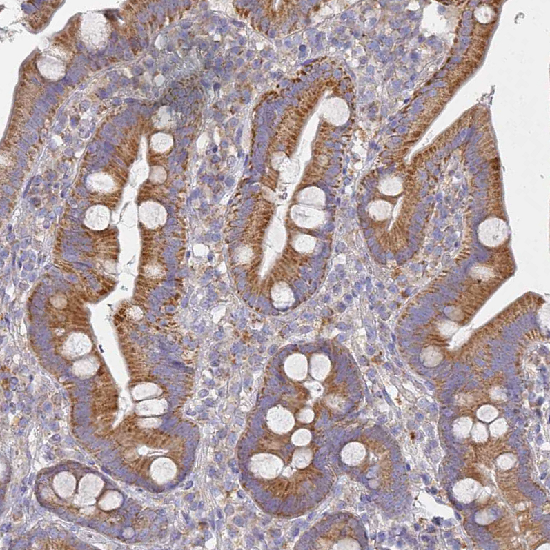 Atlas Antibodies Anti-NPEPPS Antibody