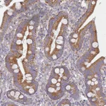 Atlas Antibodies Anti-NPEPPS Antibody