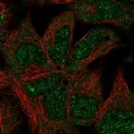 Atlas Antibodies Anti-NPHP4 Antibody