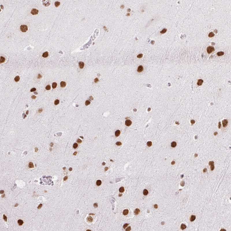 Atlas Antibodies Anti-NPIPA1 Antibody