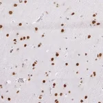 Atlas Antibodies Anti-NPIPA1 Antibody