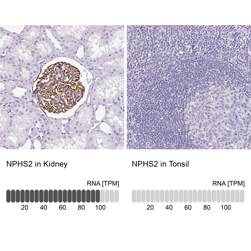 Atlas Antibodies Anti-NPHS2 Antibody