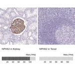 Atlas Antibodies Anti-NPHS2 Antibody
