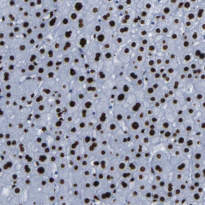 Atlas Antibodies Anti-NPIPB15 Antibody