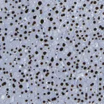 Atlas Antibodies Anti-NPIPB15 Antibody