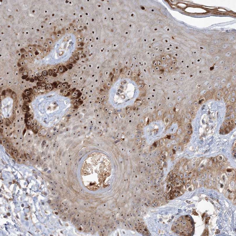 Atlas Antibodies Anti-NPM3 Antibody