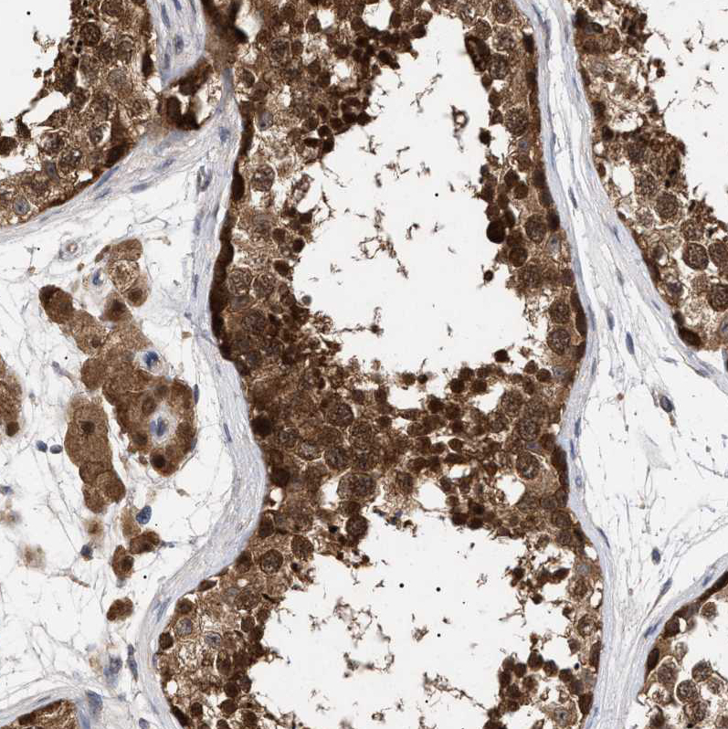 Atlas Antibodies Anti-NPLOC4 Antibody