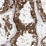 Atlas Antibodies Anti-NPLOC4 Antibody