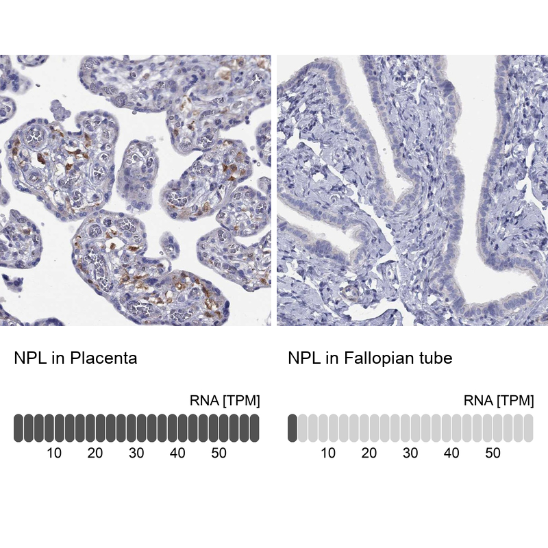 Atlas Antibodies Anti-NPL Antibody