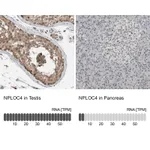 Atlas Antibodies Anti-NPLOC4 Antibody