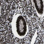 Atlas Antibodies Anti-NPM1 Antibody