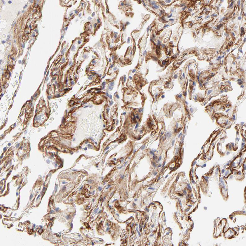 Atlas Antibodies Anti-NPNT Antibody