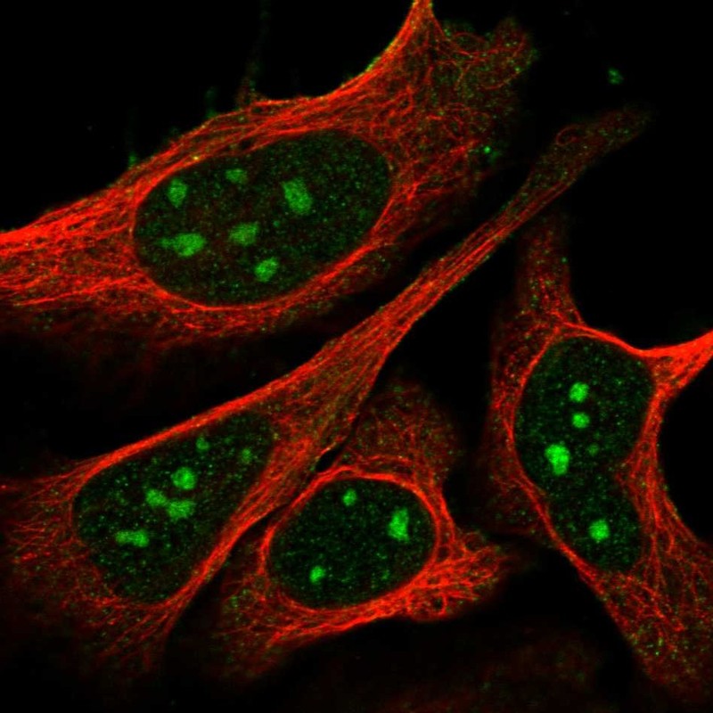 Atlas Antibodies Anti-NPR1 Antibody