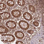 Atlas Antibodies Anti-NPRL2 Antibody