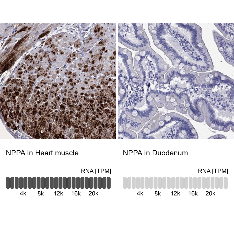 Atlas Antibodies Anti-NPPA Antibody