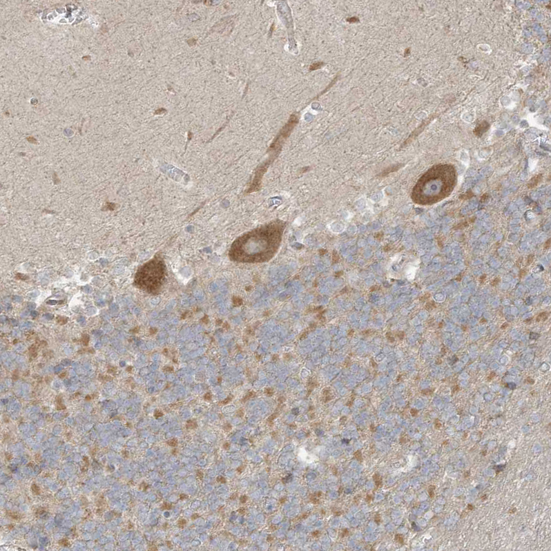 Atlas Antibodies Anti-NPPC Antibody