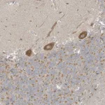 Atlas Antibodies Anti-NPPC Antibody