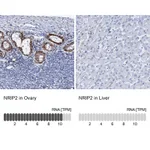 Atlas Antibodies Anti-NRIP2 Antibody