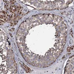 Atlas Antibodies Anti-NRIP3 Antibody