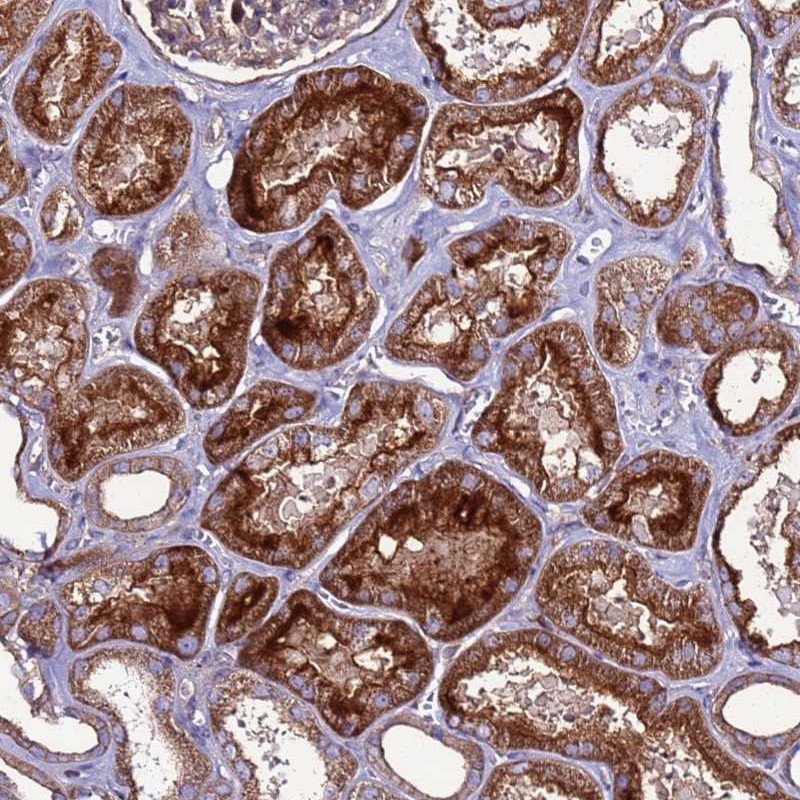 Atlas Antibodies Anti-NRN1L Antibody