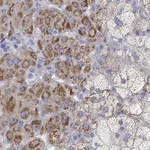 Atlas Antibodies Anti-NRIP3 Antibody