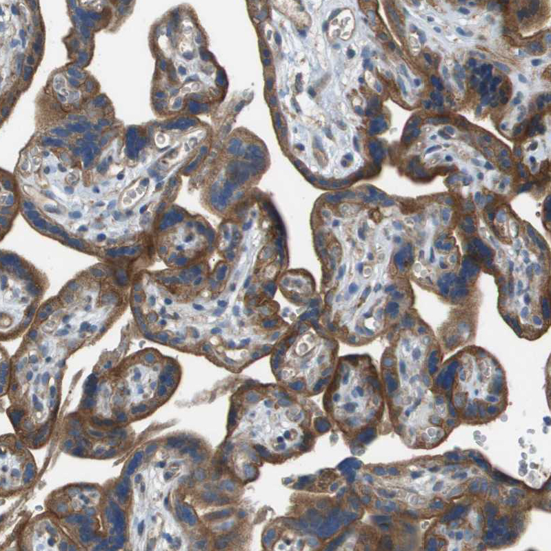 Atlas Antibodies Anti-NRK Antibody