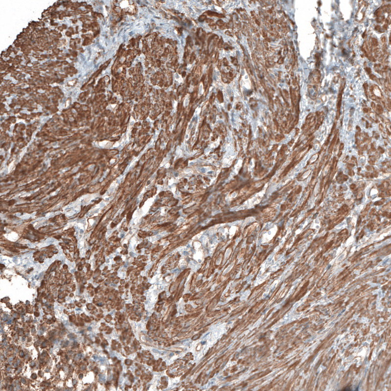 Atlas Antibodies Anti-NRP2 Antibody