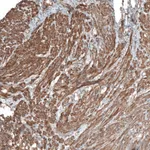 Atlas Antibodies Anti-NRP2 Antibody