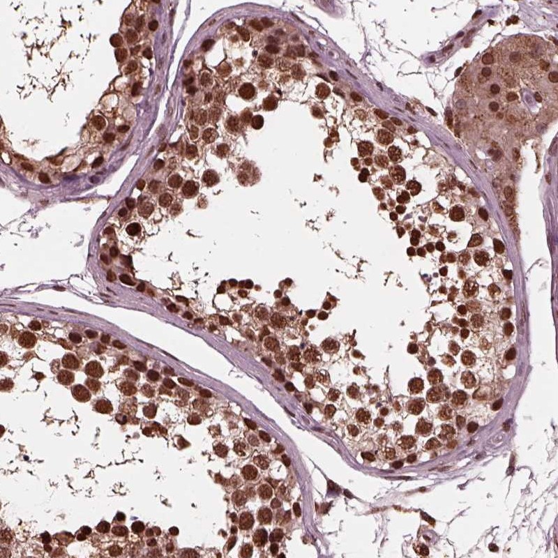 Atlas Antibodies Anti-NSD1 Antibody