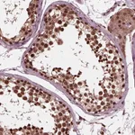 Atlas Antibodies Anti-NSD1 Antibody