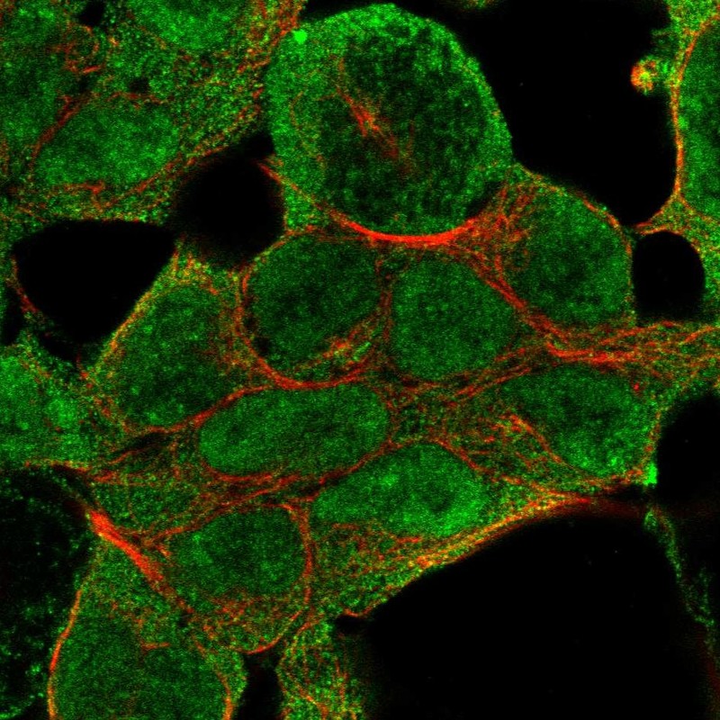 Atlas Antibodies Anti-NSD1 Antibody