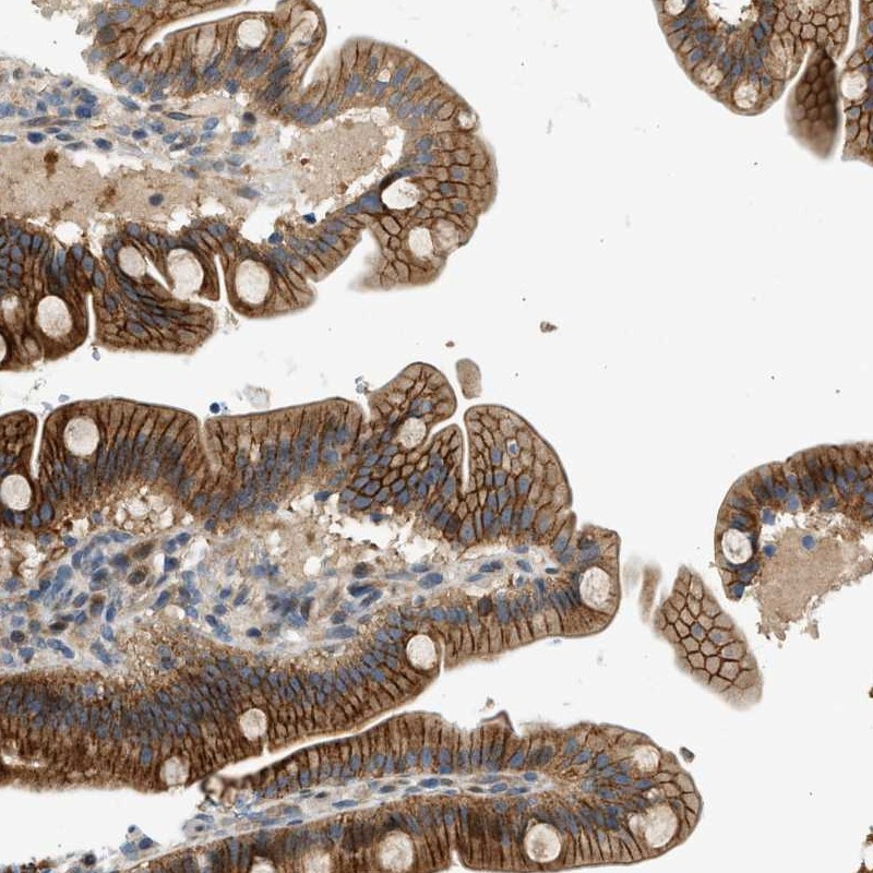 Atlas Antibodies Anti-NRSN2 Antibody