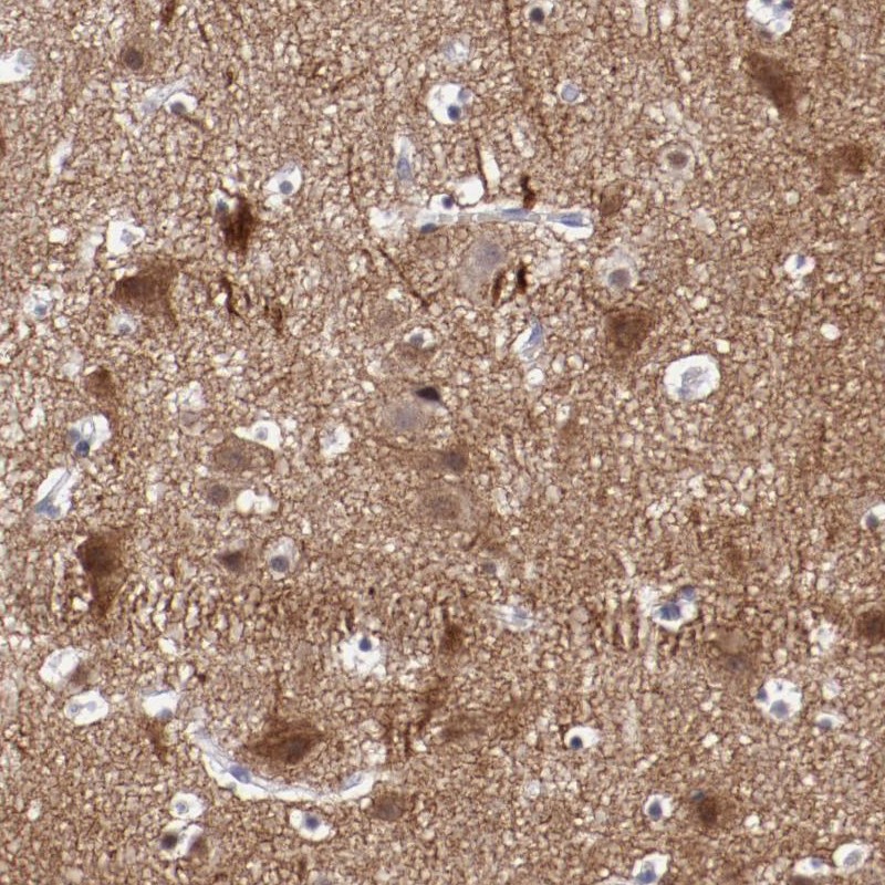 Atlas Antibodies Anti-NRXN3 Antibody