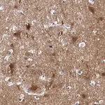 Atlas Antibodies Anti-NRXN3 Antibody