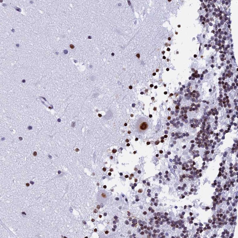 Atlas Antibodies Anti-NSA2 Antibody