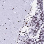 Atlas Antibodies Anti-NSA2 Antibody