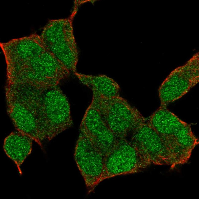 Atlas Antibodies Anti-NSD1 Antibody